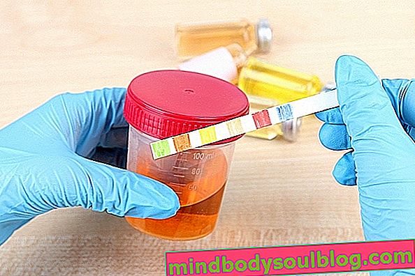 Hémoglobine dans l'urine: principales causes et comment les identifier