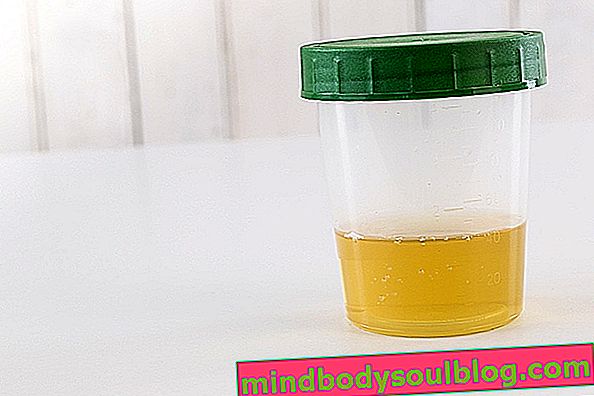 Leucocytes élevés dans l'urine: ce que cela peut être et que faire