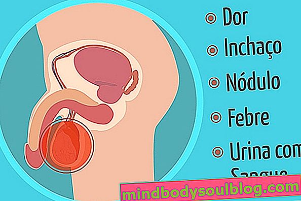 Symptômes les plus courants de l'inflammation des testicules causée par les oreillons