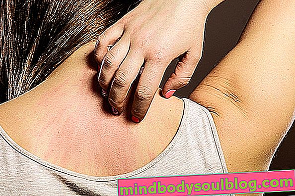 Alergi kulit: penyebab utama dan cara merawatnya
