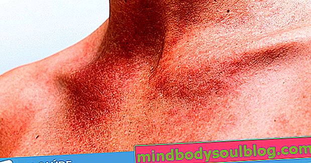 אלרגיה לעור: הסיבות העיקריות וכיצד לטפל