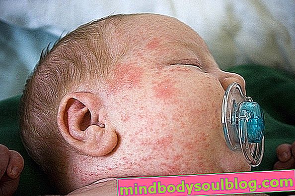 חלב סויה לתינוק: מתי להשתמש ומה הסכנות