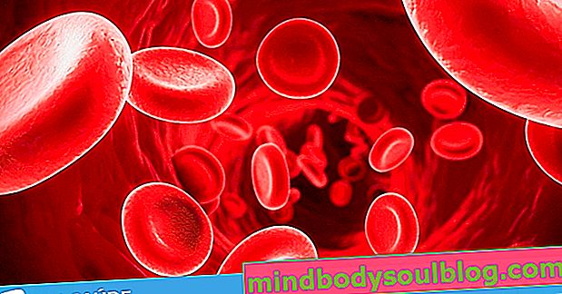 Bagaimana mengetahui apakah itu anemia: gejala dan diagnosis
