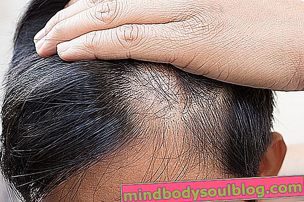 Heilmittel gegen männliche und weibliche Haarausfall