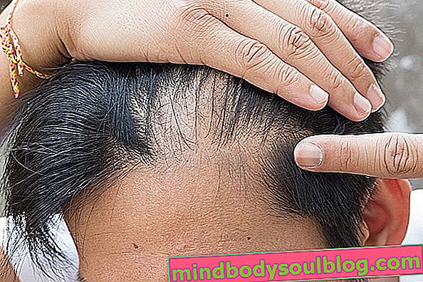 Chute de cheveux: 7 causes principales et que faire