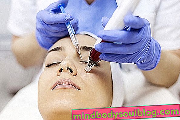 7 Ästhetische Behandlungen für Augenringe