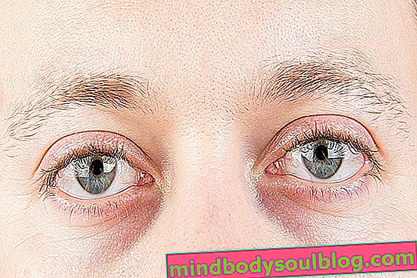 Carboxytherapie bei Augenringen: Funktionsweise und notwendige Pflege