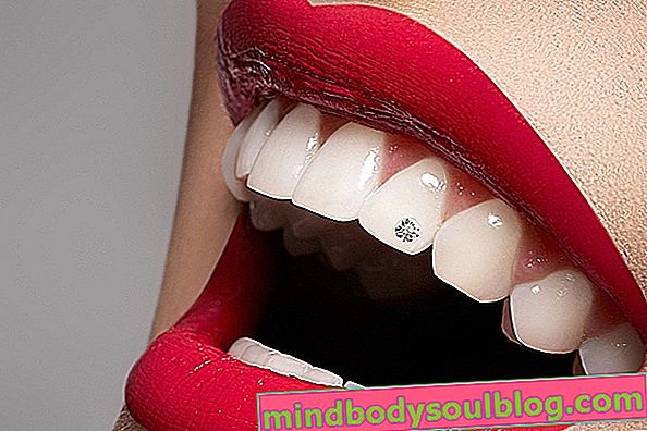 Was ist Zahnpiercing und wie soll man es ausdrücken?