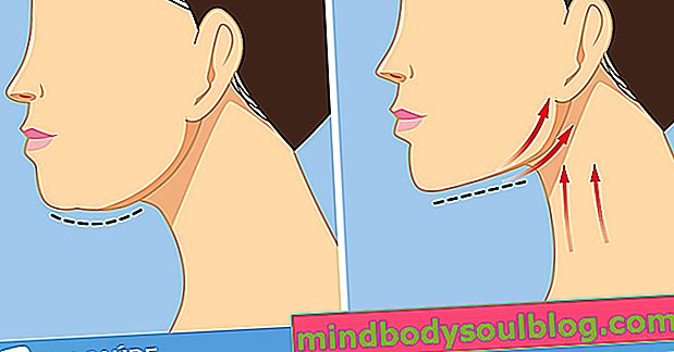 3 cara untuk mengakhiri rahang leher