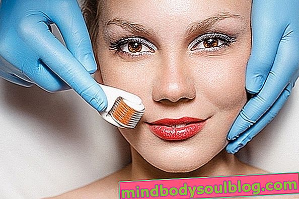 7 Möglichkeiten, um Aknenarben von Ihrem Gesicht zu bekommen