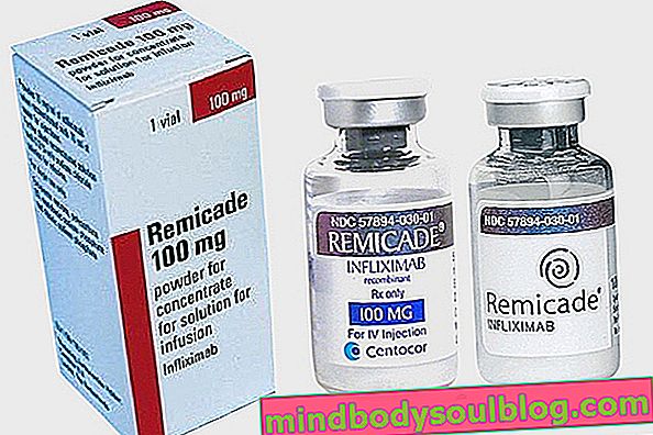 Remicade - środek, który zmniejsza stan zapalny