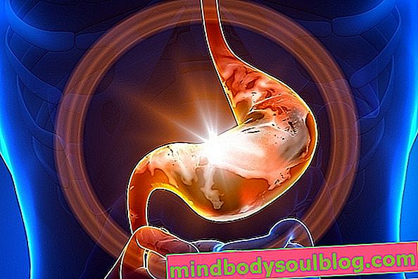 胃ポリープ：それらが何であるか、症状と原因