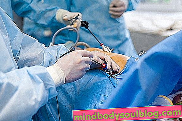 Operasi vesikel: bagaimana itu dilakukan dan bagaimana pemulihannya