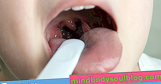 Прокашлювання: 5 способів застрягти мокроту в горлі
