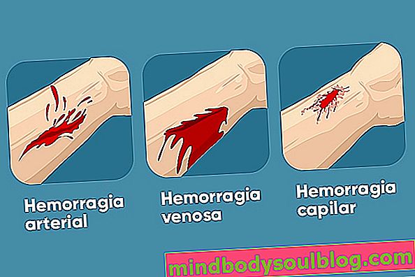 Як визначити та лікувати різні типи крововиливів