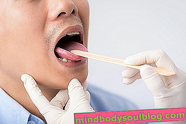 6 Hauptkrankheiten der Zunge und wie zu behandeln
