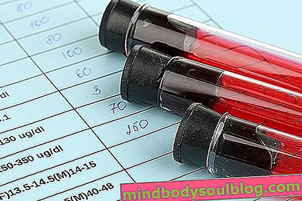 血中pH：理想的な値、測定方法および症状