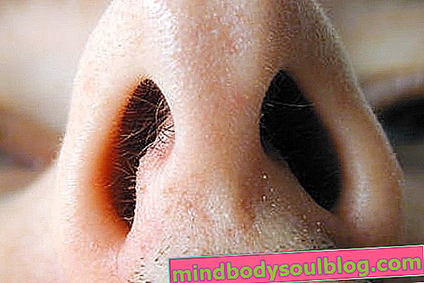 Septum hidung yang menyimpang: apa itu, gejala dan pembedahan