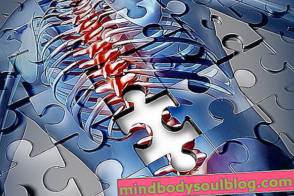 Trauma tulang belakang: apa itu, mengapa itu terjadi dan pengobatannya