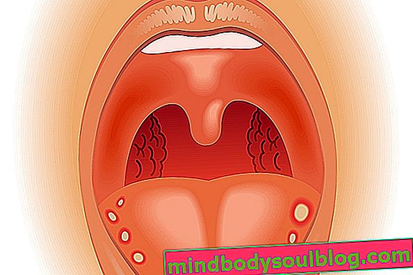 Was können Bälle auf der Zunge sein und was zu tun ist