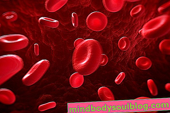 赤血球増加症とは何か、原因、特定および治療方法