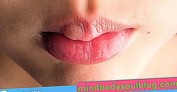 口の腫れの7つの主な原因と何をすべきか