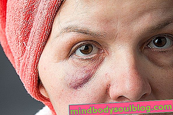 顔の腫れ：収縮する原因と対処法