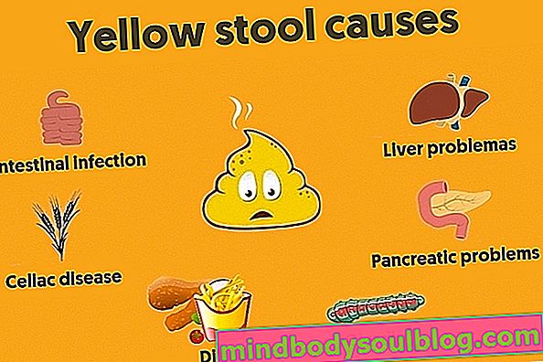 7 causes de merde jaune et comment les traiter