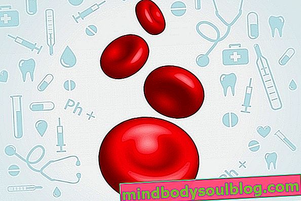大赤血球症の主な原因と何をすべきか