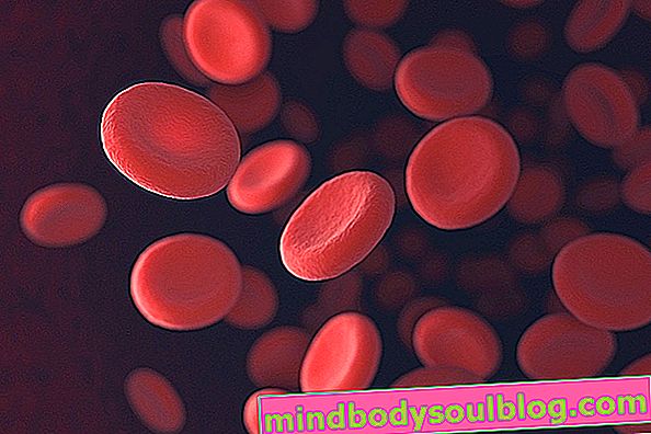 悪性貧血：症状、診断および治療