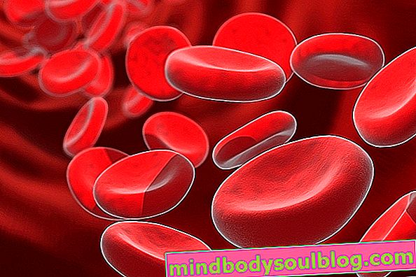 Anemia hemolitik: apa itu, gejala utama dan pengobatan