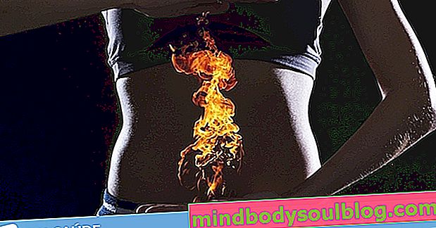 Top 10 des causes de brûlures d'estomac et de brûlures