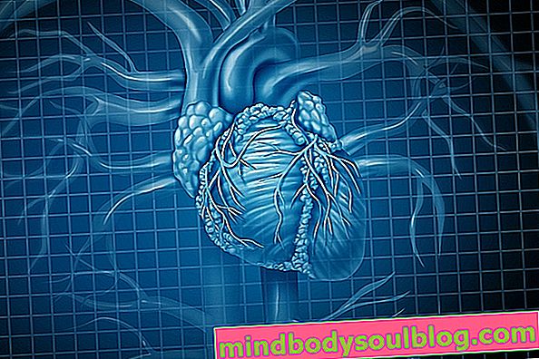Großes Herz (Kardiomegalie): Was es ist, Symptome, Ursachen und Behandlung
