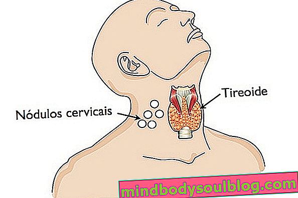 Местоположение на щитовидната жлеза