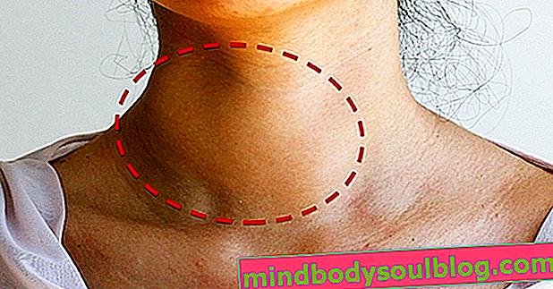 Възел на щитовидната жлеза: какво е това, симптоми и как да се лекува