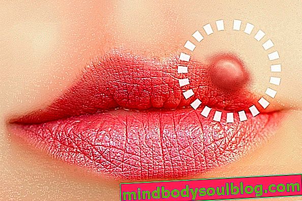 7 maladies transmises par les baisers