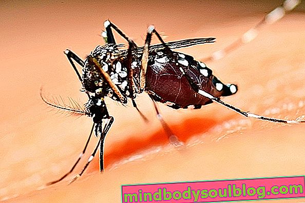 Hauptkomplikationen von Dengue-Fieber
