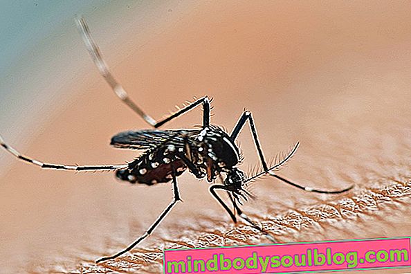 Principales complications de la dengue