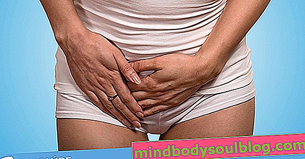 膀胱炎とは何か、主な症状、原因、治療