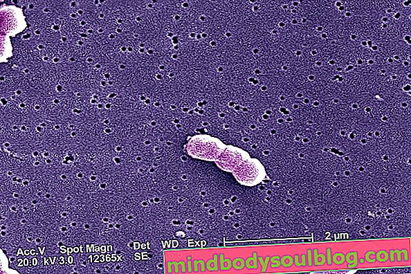 كيف تحدث عدوى Acinetobacter والأعراض والعلاج