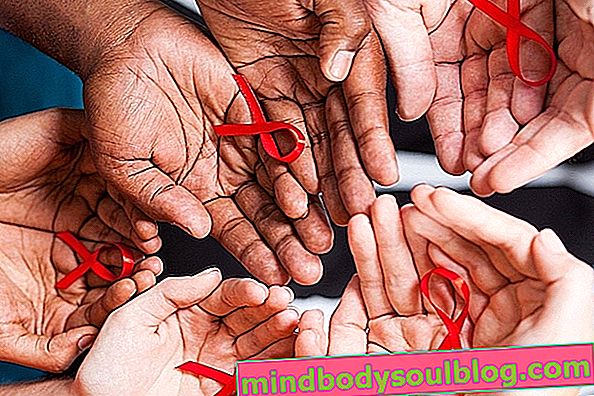 Semua mengenai AIDS dan HIV: apa itu, sejarah, gejala dan rawatan