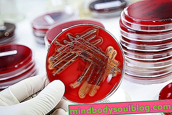 Staphylococci (Staphylococcus): apa itu, spesies dan gejala utama