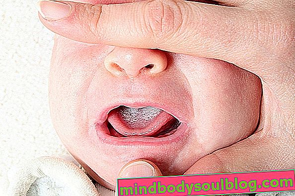 Wie man Baby Soor identifiziert und heilt