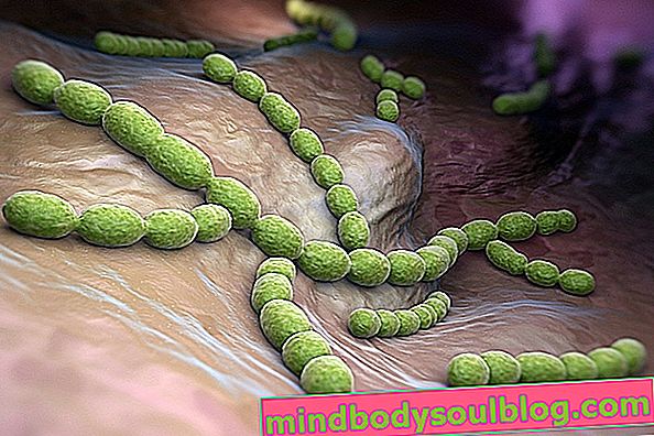 Streptococcus: Was es ist, wie man es bekommt und Hauptsymptome