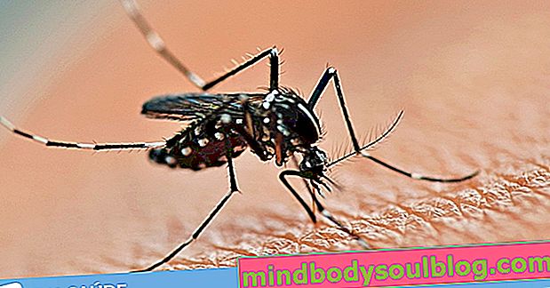 Hauptsymptome von klassischem und hämorrhagischem Dengue-Fieber