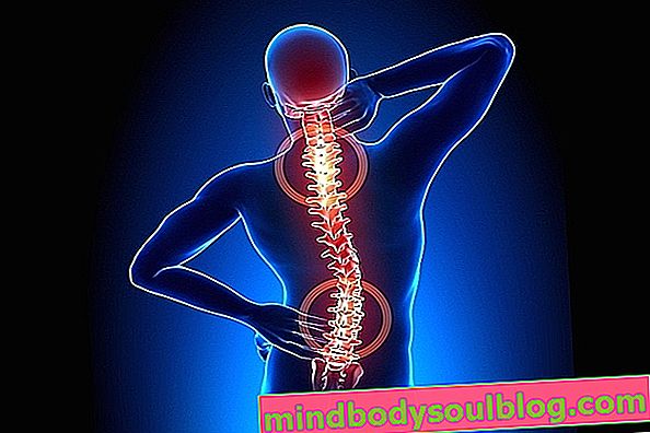 腰部脊椎関節症：それが何であるか、症状と治療