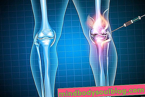 Какво представлява инфилтрацията на коляното, за какво е и как се прави