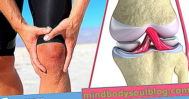 5 conseils pour soulager la douleur au genou