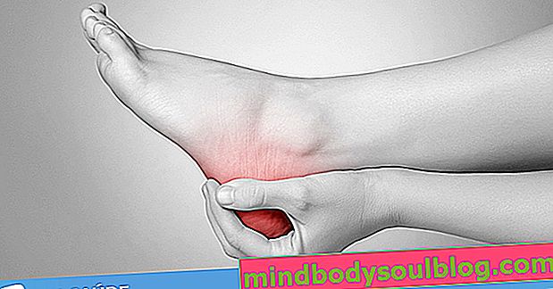 כאב בסוליית כף הרגל עם ההשכמה (plantar fasciitis): גורם וטיפול