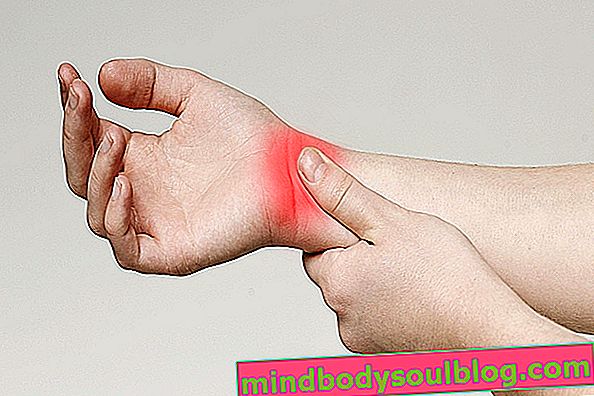 Tendonitis pergelangan tangan: penyebab dan pengobatan
